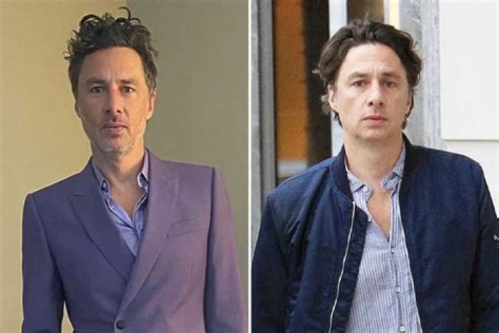 Unbelievable Zach Braff: The Truth About His Rumored Plastic Surgery